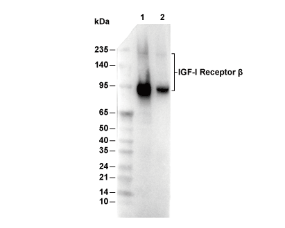IGF-1R&beta; Antibody [G20F1] WB