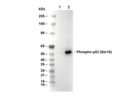 Phospho-p53 (Ser15) Antibody [C9F23] WB