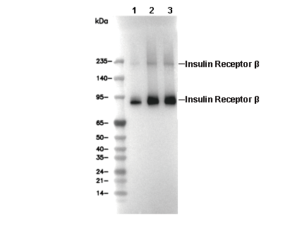 Insulin Receptor &beta; Antibody [C9B17] WB