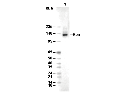 Ron Antibody [E10H2] WB
