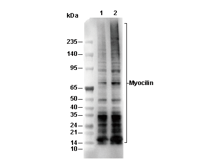 K63-linkage Specific Polyubiquitin Antibody [P10B21] WB