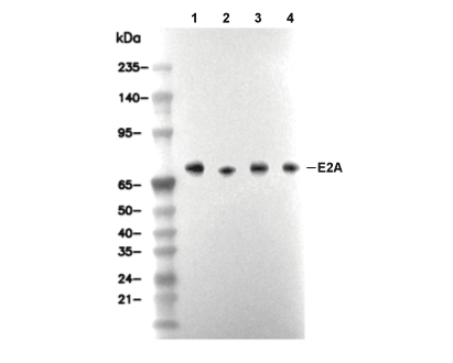 E2A Antibody [E15P20] WB