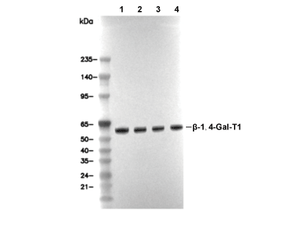 &beta;-1,4-Gal-T1 Antibody [C2J8] WB