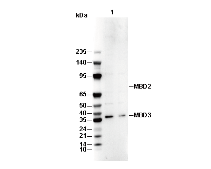 RNase L Antibody [A1K22] WB