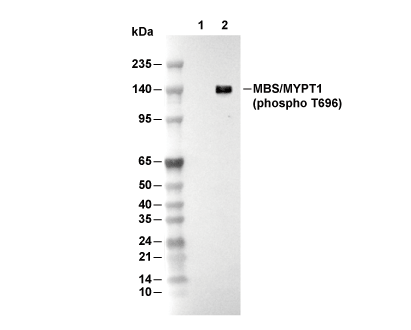 Phospho-MBS/MYPT1 (Thr696) Antibody [K5H5] WB