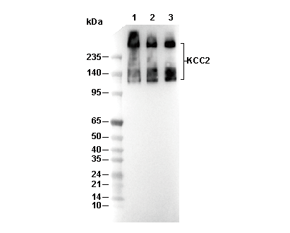 KCC2 Antibody [K20G10] WB