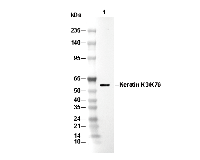 Keratin K3/K76 Antibody [A4J6] WB