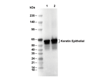 Keratin Epithelial Antibody [J4M17] WB