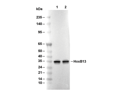 HoxB13 Antibody [E5D22] WB