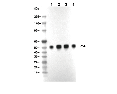 PSR Antibody [F14P18] WB