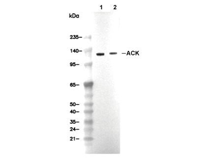 ACK Antibody [B23C14] WB