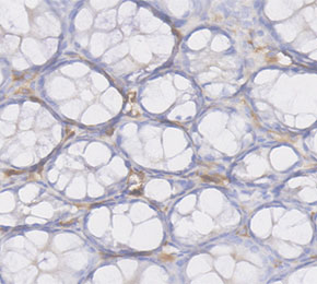F4576-IHC1