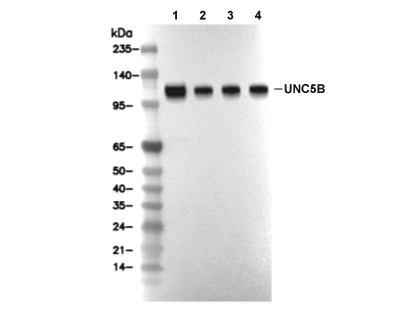UNC5B Antibody [H18P14] WB
