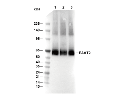 EAAT2 Antibody [C22G14] WB