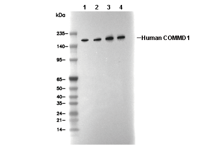 Clathrin Heavy Chain Antibody [N1G10] WB
