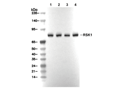 RSK1 Antibody [P7B9] WB