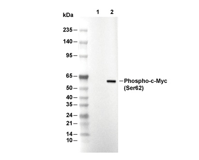 Phospho-c-Myc (Ser62) Antibody [M18C23] WB