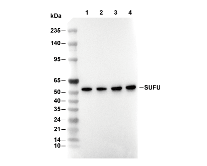 SUFU Antibody [B21L1] WB