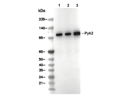 Pyk2 Antibody [L19B9] WB