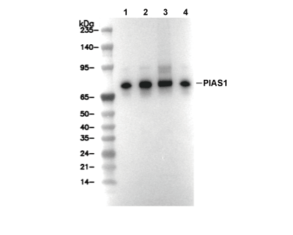 PIAS1 Antibody [J24P15] WB