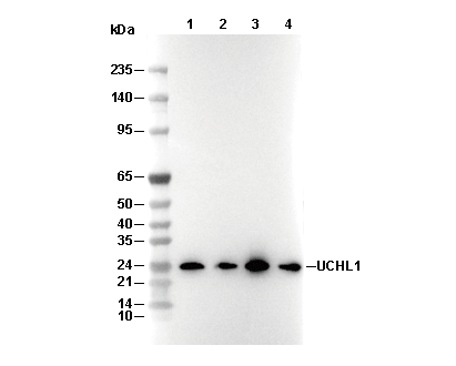 UCHL1 Antibody [A3D22] WB
