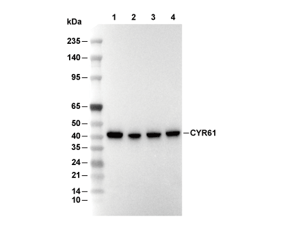 CYR61 Antibody [M15N8] WB