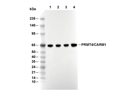 PRMT4/CARM1 Antibody [J8A9] WB