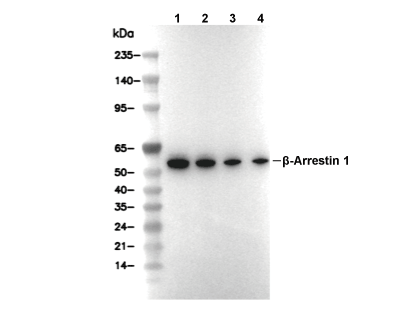 &beta; Arrestin 1 Antibody [A11H23] WB