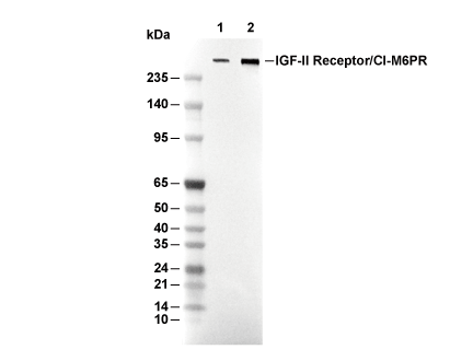 M6PR Antibody [J18A13] WB