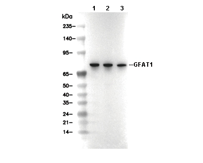 GFAT1 Antibody [D8D23] WB