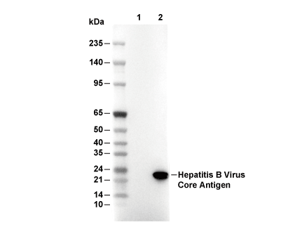 Hepatitis B Virus Core Antigen Antibody [F18P11] WB