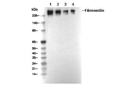 Fibronectin Antibody [C18P7] WB