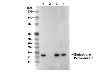 Glutathione Peroxidase 1 Antibody [M21J11] WB