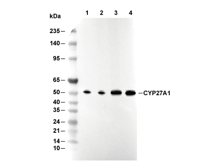 CYP27A1 Antibody [G12G9] WB