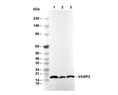 VAMP2 Antibody [M16L18] WB