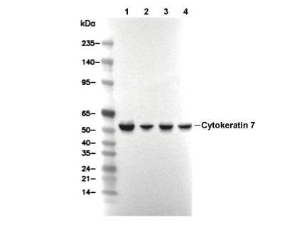 Cytokeratin 7 Antibody [H19A10] WB