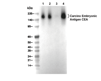 CEA/CD66e Antibody [D17P1] WB