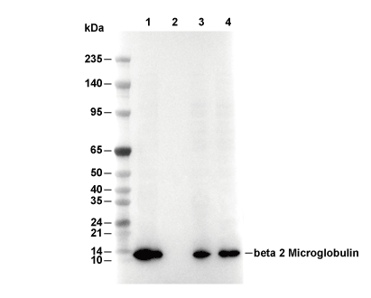 &beta;2 Microglobulin Antibody [D17A9] WB