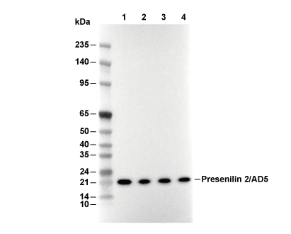 Presenilin 2 Antibody [M18A3] WB