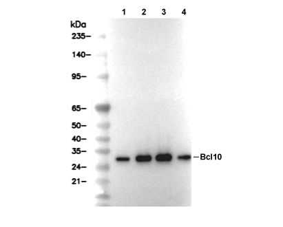 Bcl10 Antibody [J3K14] WB