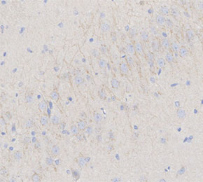 F4944-IHC1