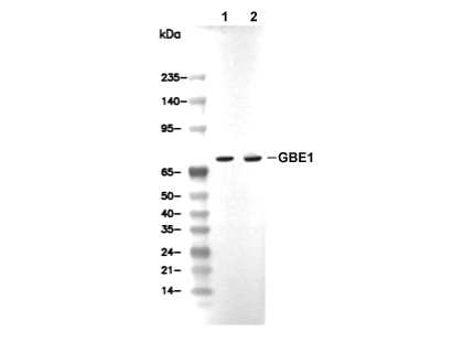 GBE1 Antibody [P1M6] WB