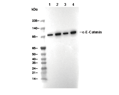 &alpha;-E-Catenin Antibody [D17G1] WB