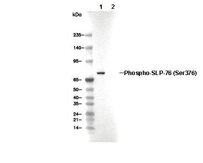 Phospho-SLP-76 (Ser376) Antibody [D2F12] WB