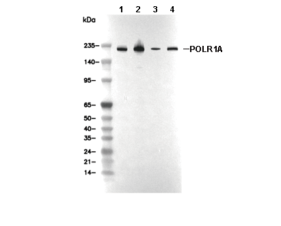 POLR1A Antibody [E1L22] WB