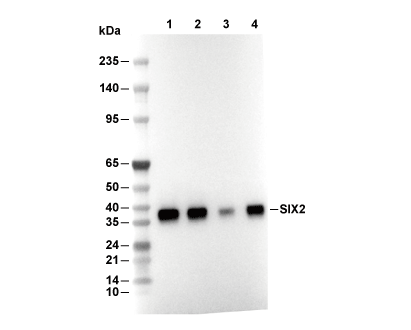 SIX2 Antibody [E17K9] WB