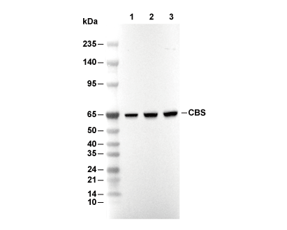 CBS Antibody [J23E1] WB