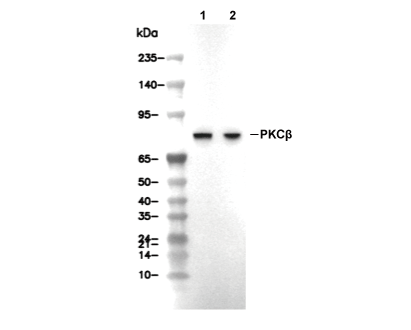 PKC&beta; Antibody [B15A17] WB