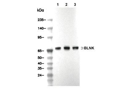 BLNK Antibody [L16M19] WB
