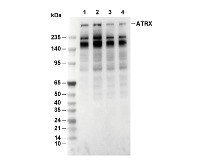 ATRX Antibody [B2B21] WB